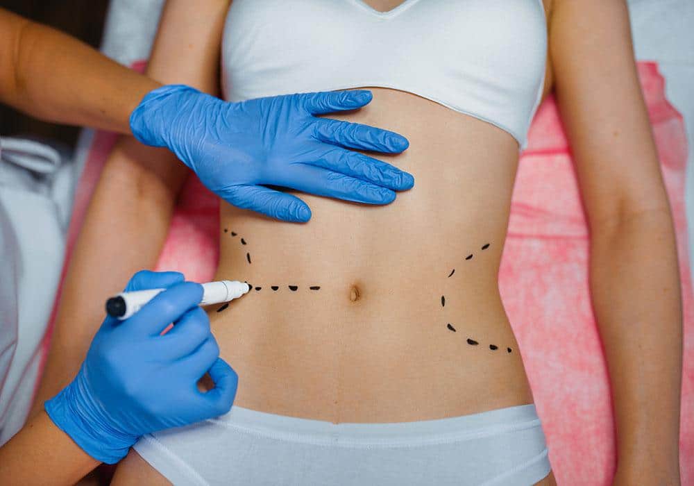 Bariatric Surgery in Islamabad 1