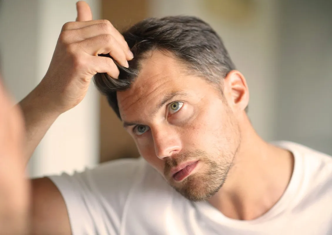 hair loss treatment London